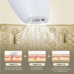 Professional Laser Epilator IPL Hair Removal