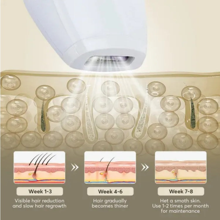 Professional Laser Epilator IPL Hair Removal