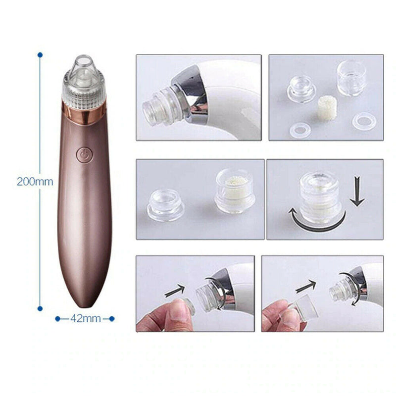 Electric Blackhead Vacuum Pore Cleaner Acne Pimple Remover Strong