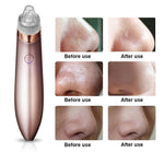 Electric Blackhead Vacuum Pore Cleaner Acne Pimple Remover Strong