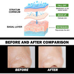 Bamboo Charcoal Peel-Off Mask for Blackhead & Acne Control, Deep