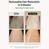 Professional Laser Epilator IPL Hair Removal