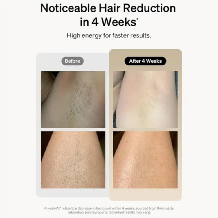 Professional Laser Epilator IPL Hair Removal