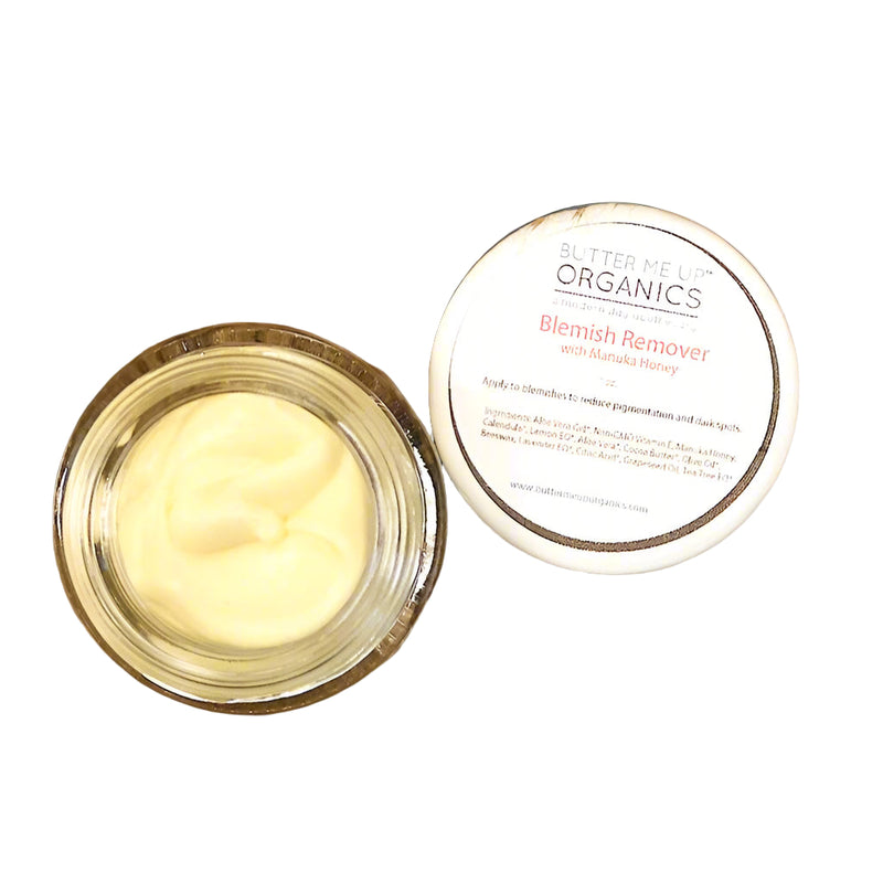 Organic Blemish Cream – Dark Spot, Scar & Acne Spot Treatment