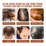 EELHOE Batana Oil Conditioner