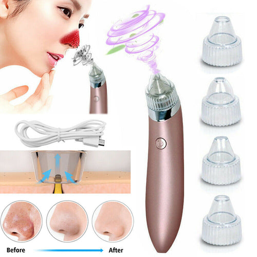 Electric Blackhead Vacuum Pore Cleaner Acne Pimple Remover Strong